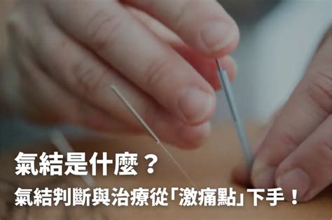 頭氣結|氣結是什麼？氣結判斷與治療從「激痛點」下手！